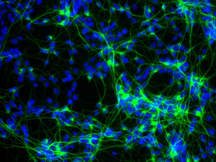 Neurons under microscope Neurons under microscope
